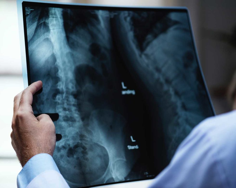 medical-1600-web medical industry x-ray scan